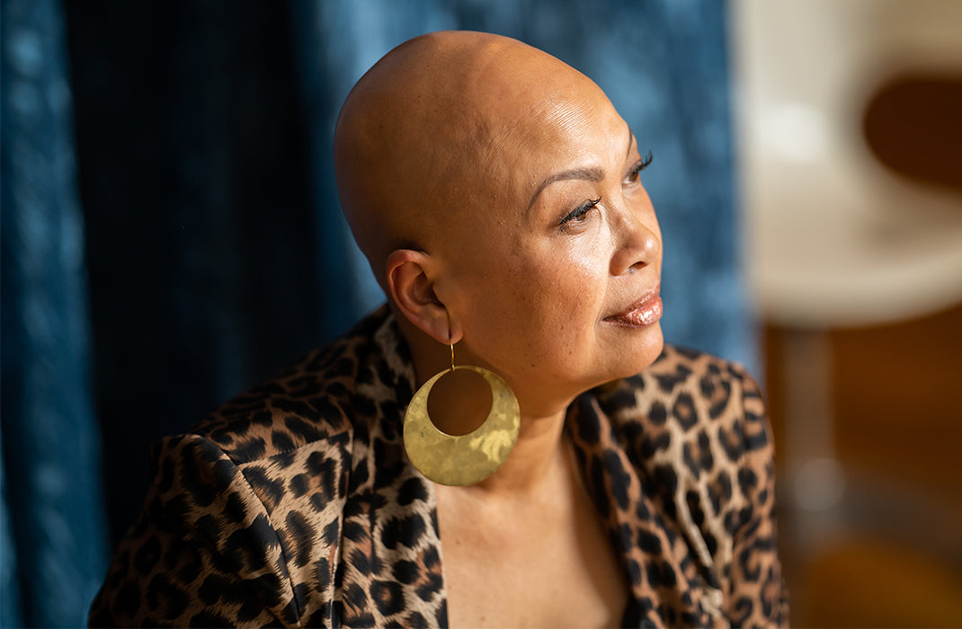 Shining A Light On Alopecia Awareness Month Shining A Light On Alopecia Awareness Month