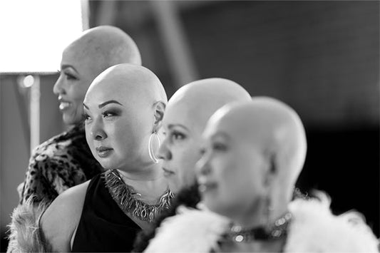 Breaking Barriers: Alopecia Photoshoot Recap