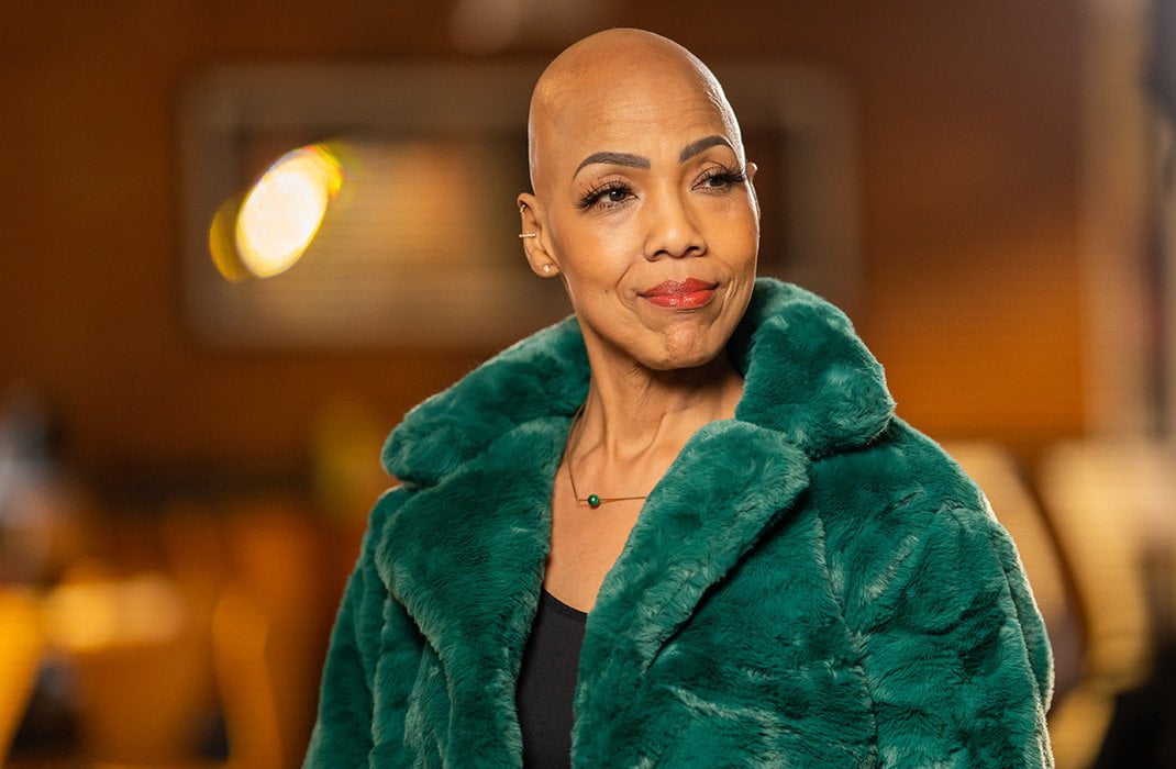 Alopecia 101