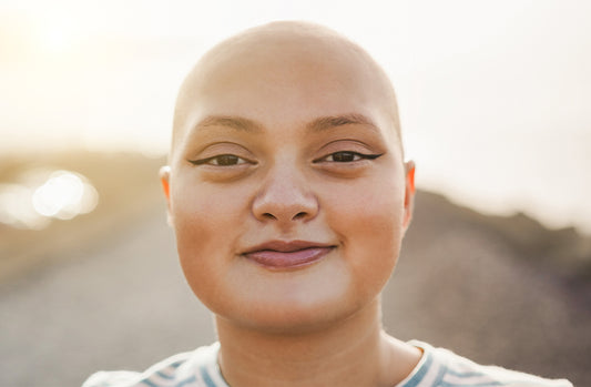 How to Handle Hair Loss from Chemotherapy