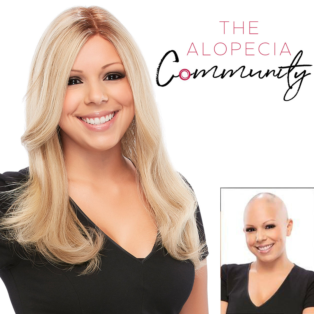 The Online Alopecia Community