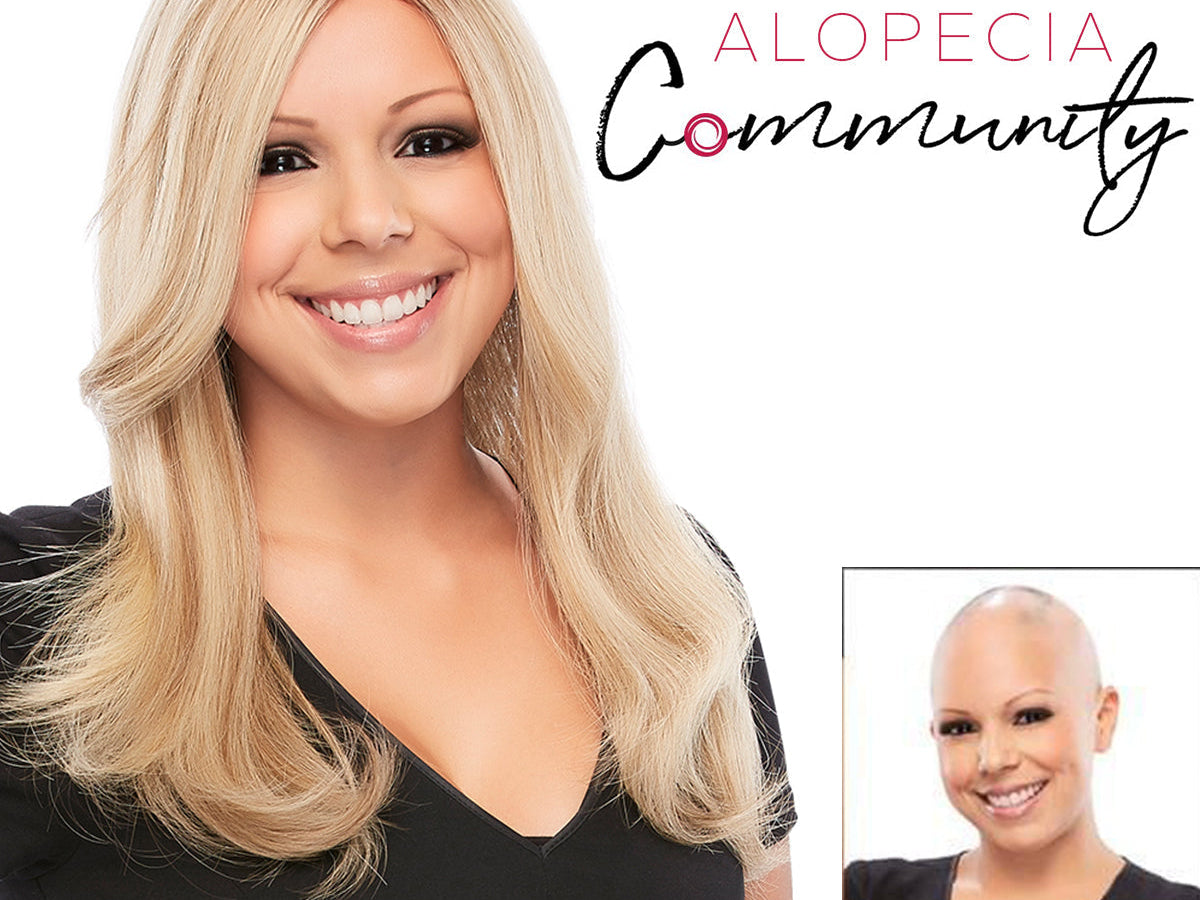 The Online Alopecia Community