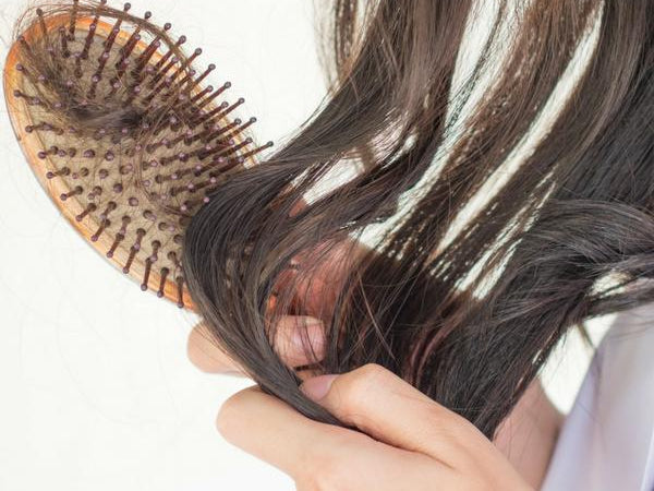 Do Wigs Cause Hairloss?