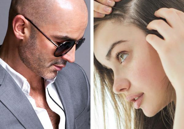 Hair Loss | Male VS. Female