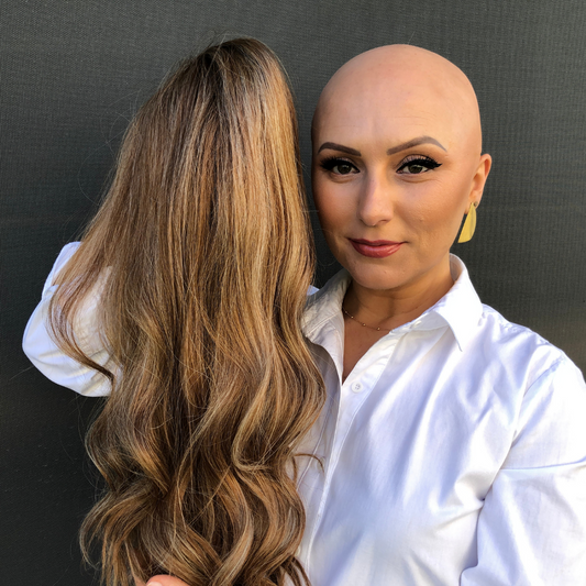 Alopecia 101