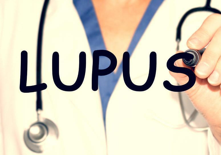 Can Lupus Cause Hair Loss?