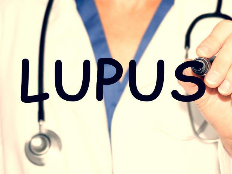 Can Lupus Cause Hair Loss?