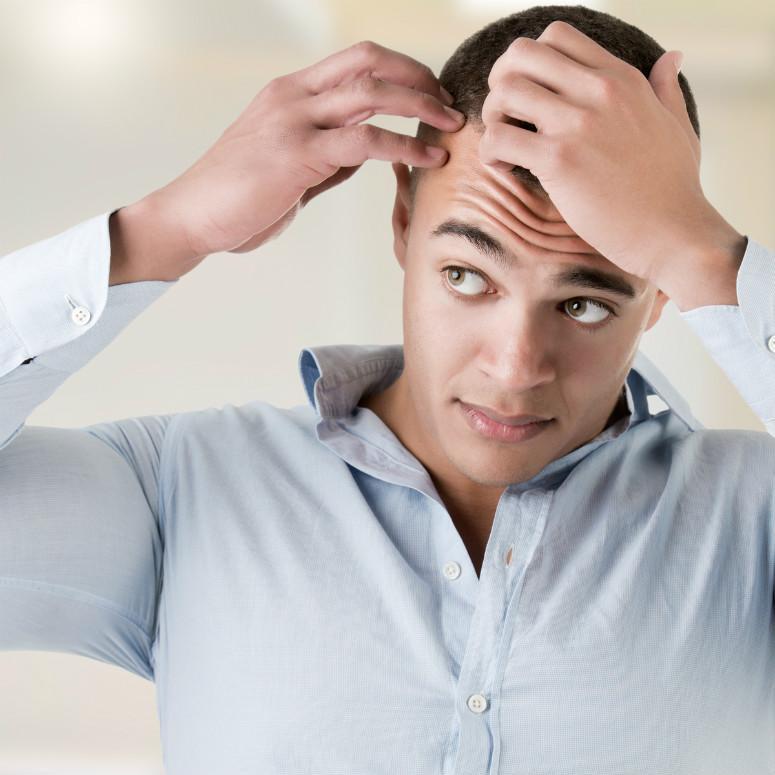 What Causes Hair Loss in Men?