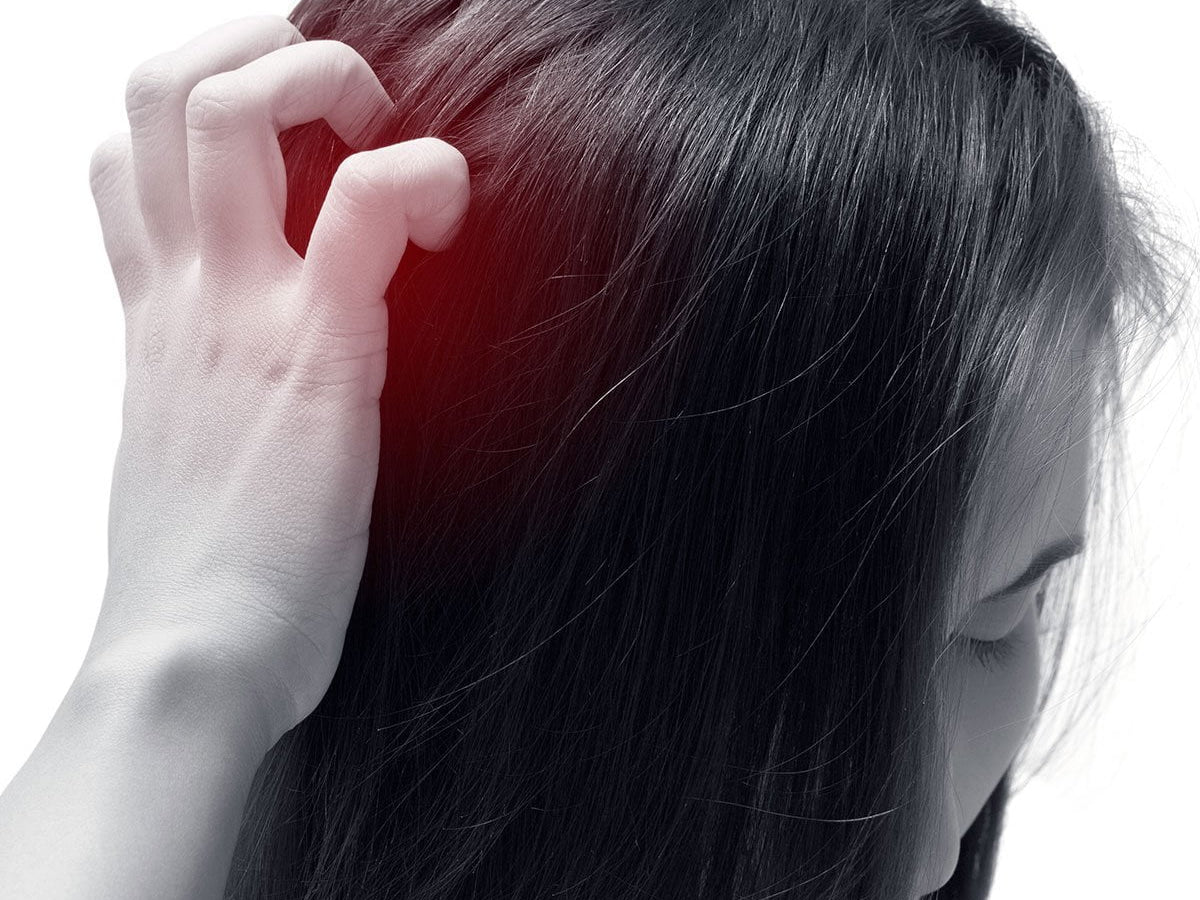 scalp pain causes