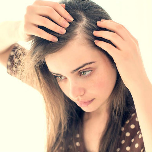 All About Traction Alopecia
