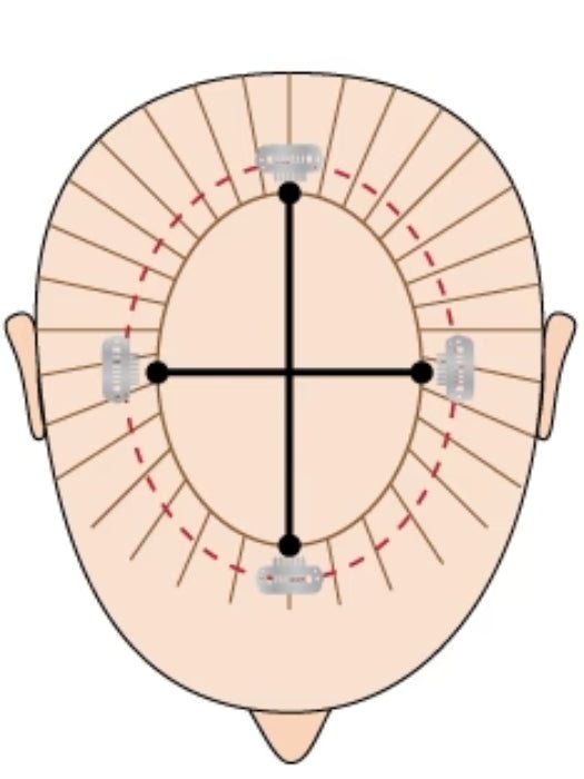 a diagram of how to measure for your hair topper